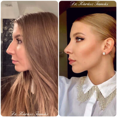 Páciens eredmény