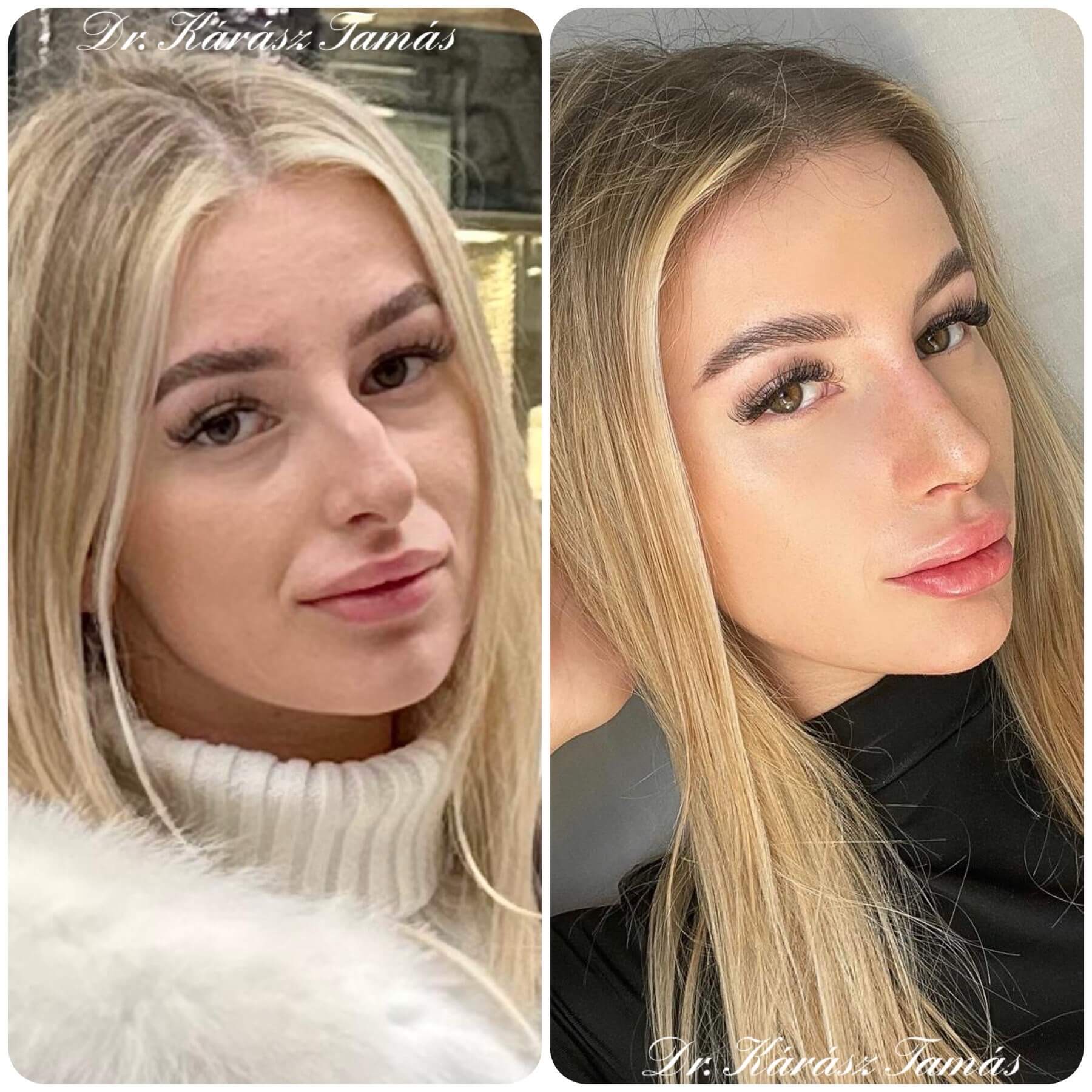 Páciens eredmény